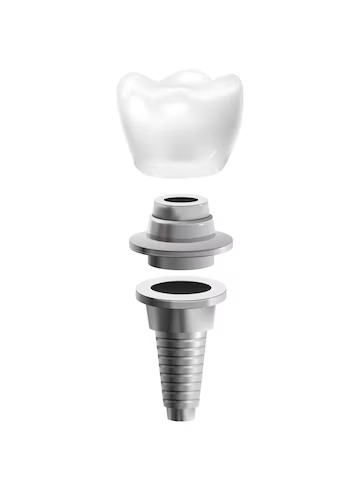 Dental Implant FAQ
Missing tooth?  Your smile is the key to success in your social and professional life. #ChangeYourSmileChangeYourLife @ChangeYourSmileChangeYourLife  Dental implant maybe the easiest, most affordable and painless solution. Call today for Free consult 6045597270 @vancouverDentist @dentistry @dentalimplant 