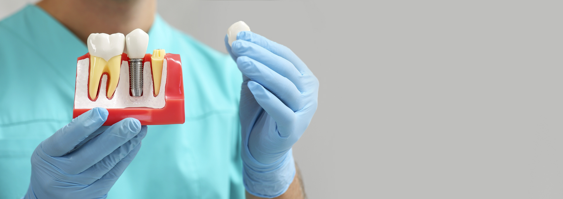 Welcome to Vancouver Dental Implant