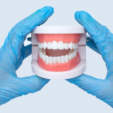 Full Mouth Dental Implants in Vancouver