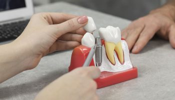 Thinking About Dental Implants? Start with a Free Consultation & Smile Confidently